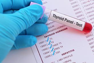 Thyroid Profile
